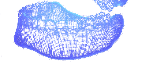 Wireframe scan of an upper and lower dental arch
